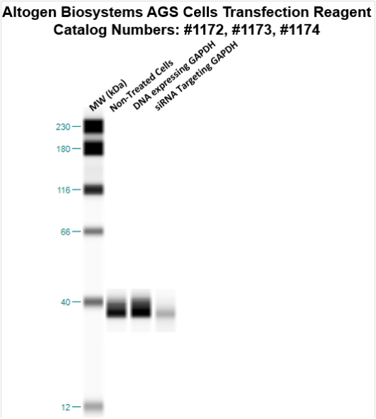 AGS Transfection Reagent (Gastric Adenocarcinoma) | Transfection ...