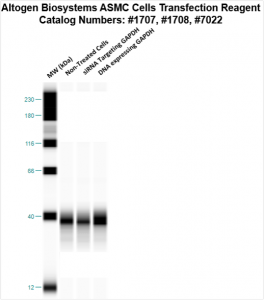 ASMC-cells-transfection-protocol