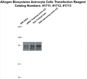 Astrocyte-cells-transfection-protocol