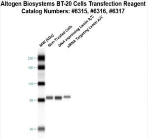 BT20-cells-transfection-protocol