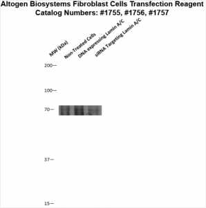 Fibroblast-cells-transfection-protocol