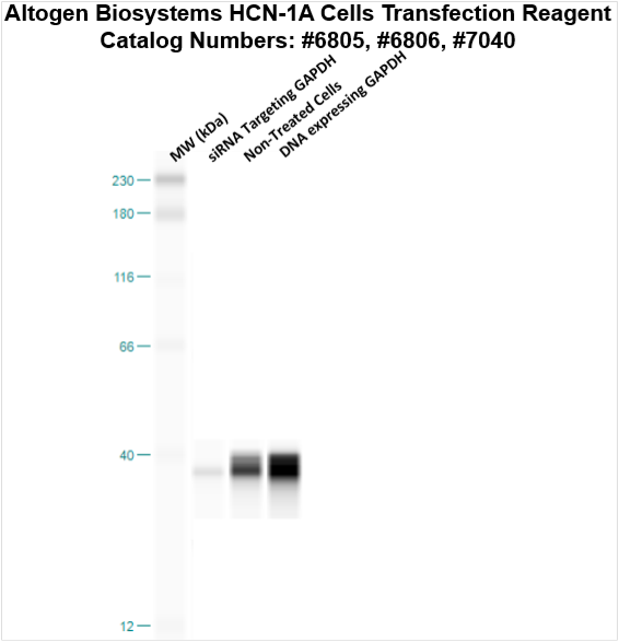 HCN-1A Transfection Reagent (Brain Neuronal Cells) | Transfection ...
