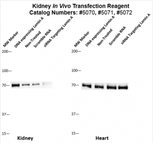 Kidney-Targeted-Transfection-Altogen-Catalog-5072-1