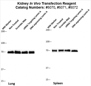 Kidney-Targeted-Transfection-Altogen-Catalog-5072-2