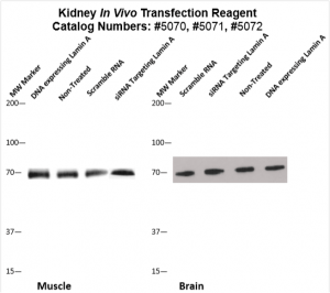 Kidney-Targeted-Transfection-Altogen-Catalog-5072-4