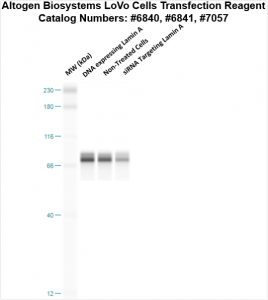 LoVo-cells-transfection-protocol