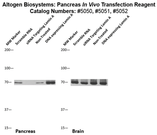 Pancreas In Vivo Transfection Kit | Transfection Reagents | Cell Lines ...