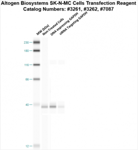 SKNMC-cells-transfection-protocol