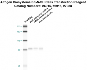 SKNSH-cells-transfection-protocol