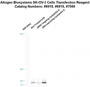 SKOV3-cells-transfection-protocol